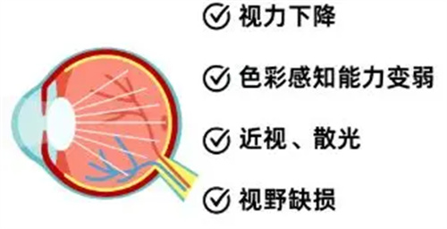 图片细节