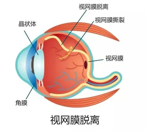 详细描述