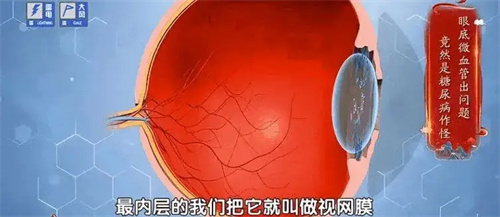 细节说明