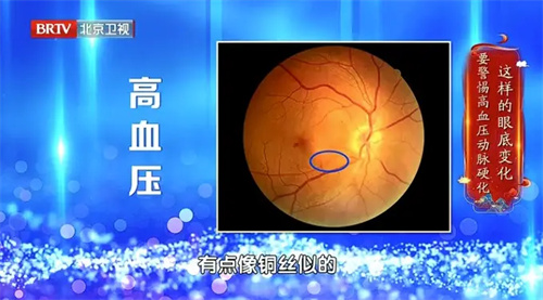 细节介绍
