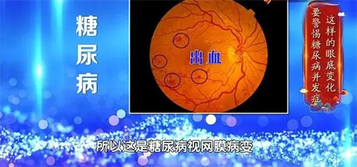 细节描述