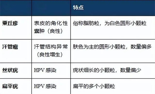 图片细节