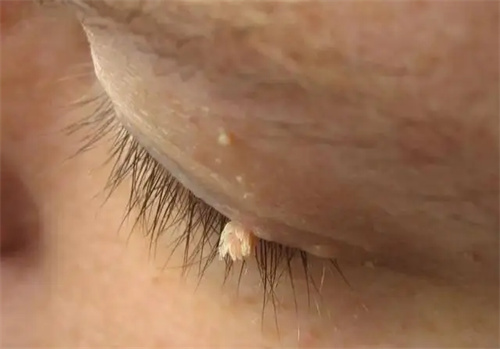 细节介绍