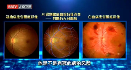 详细说明