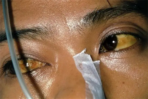 详细介绍